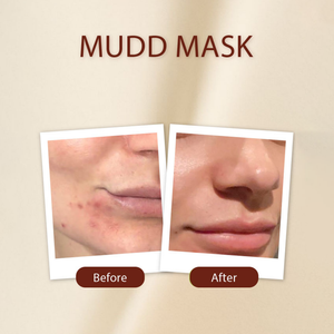 Mudd Mask - Golden Girl Cosmetics